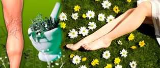 Folk remedies to combat varicose veins in the legs