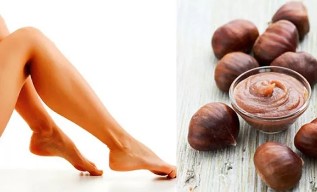The chestnut-of-india-from-varicose veins