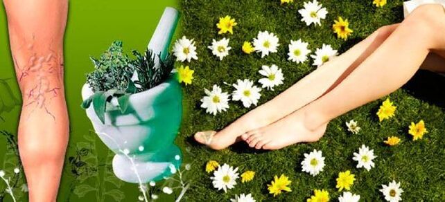 Folk remedies for varicose veins in the legs, contribute to a speedy recovery